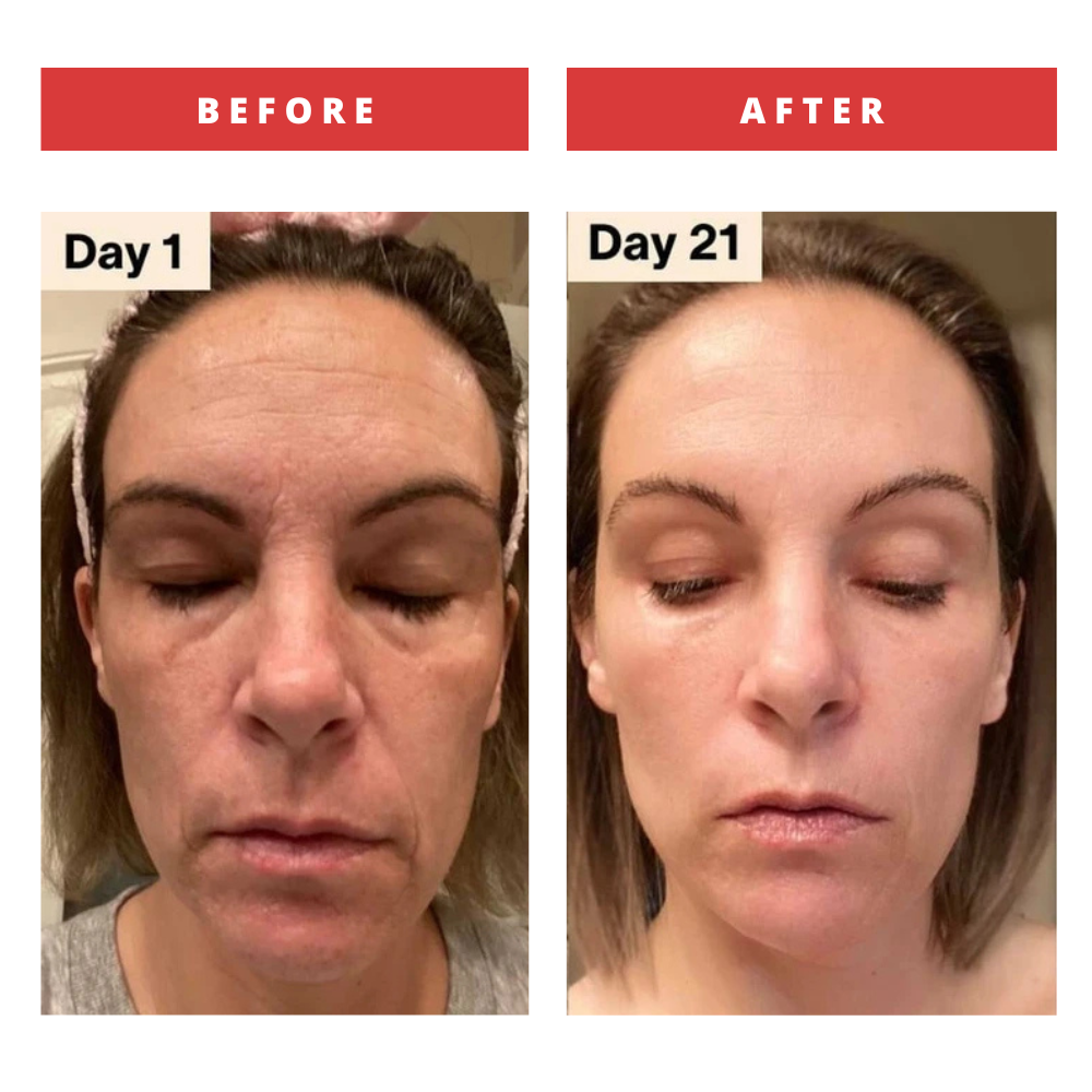 Red Light Therapy Skin Rejuvenation Mask