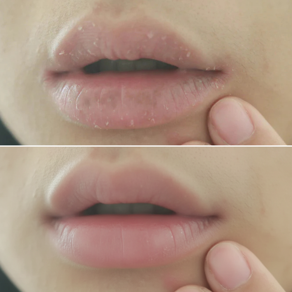 Plump Me | Natural Lip Volume