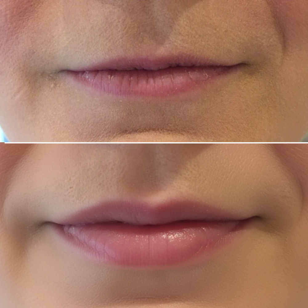 Plump Me | Natural Lip Volume